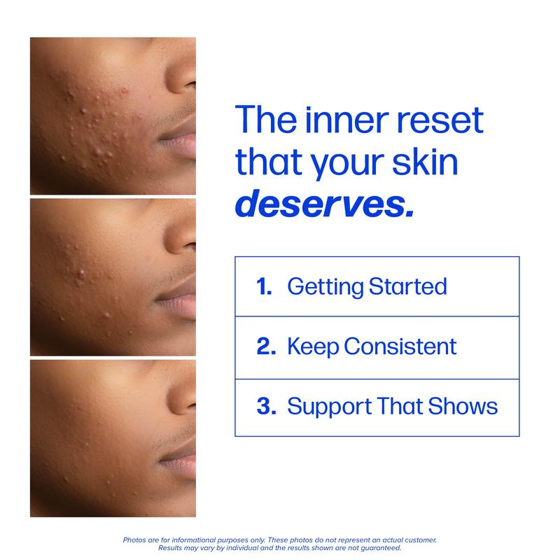 Clear Skin Support
