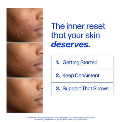 Clear Skin Support