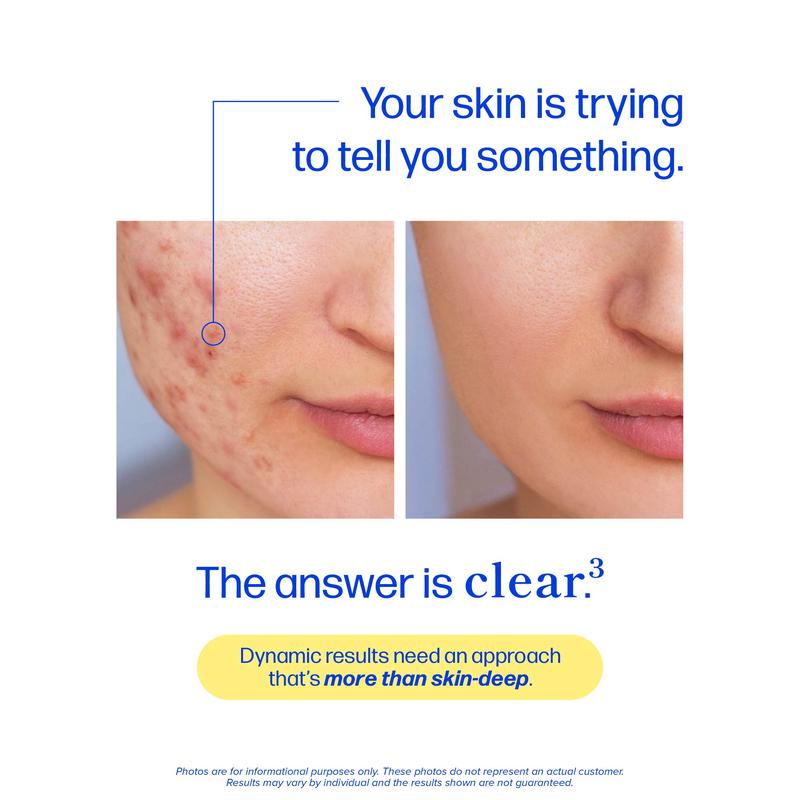 Clear Skin Support